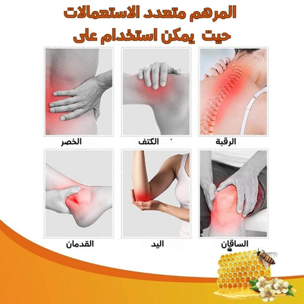 أفضل مرهم المفاصل لعلاج الالتهاب - Image 4