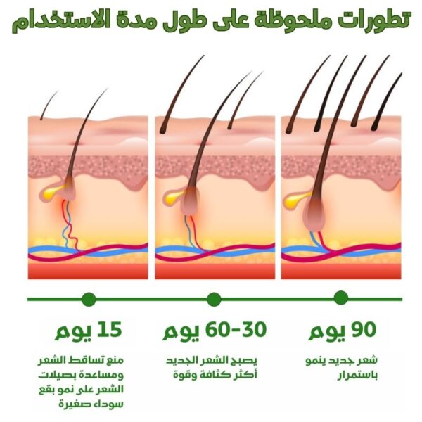 زيت اكليل الجبل - لعلاج كل مشاكل الشعر - Image 3