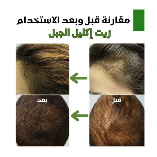 زيت اكليل الجبل - لعلاج كل مشاكل الشعر - Image 5