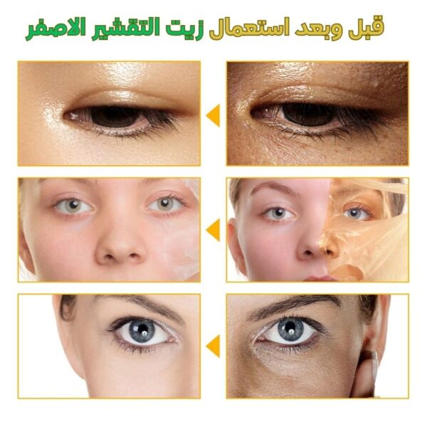 زيت تقشير اصفر - لتفتيح البشرة الداكنة - Image 4